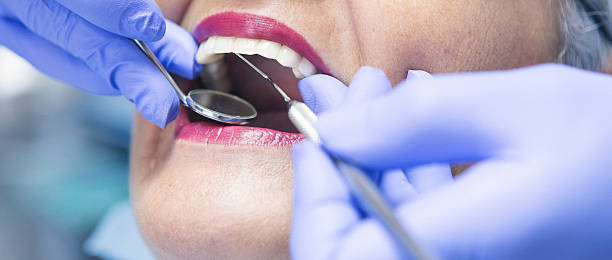 Best Emergency Dental Extractions in Kaysville, UT